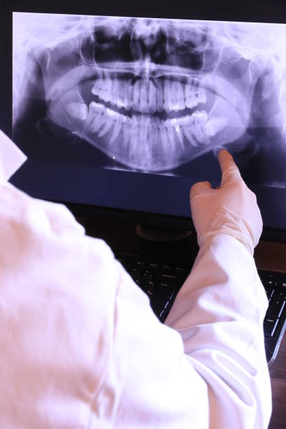 Best Emergency Dentist for Knocked-Out Tooth in Oak Grove, SC