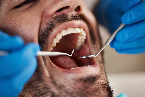 Best Emergency Dental Services for Seniors in Oak Grove, SC