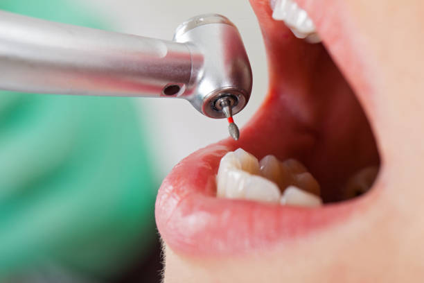 Best Pediatric Emergency Dentist in Oak Grove, SC